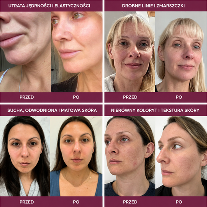 Koreański balsam wielozadaniowy PDRN Pink Collagen Volume