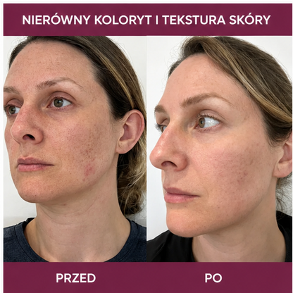 Koreański balsam PDRN Pink